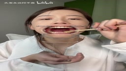 chinese mouth gag