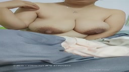 哺乳期の巨大乳房 2