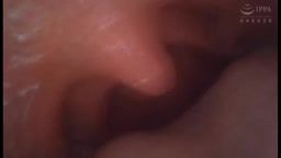 イラマチオ　歯