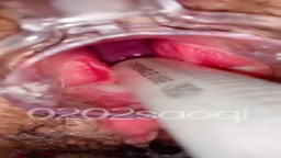 拾い　精子注入