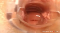 Webcam Pussy Play with Speculum