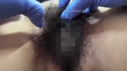 暗黒クリニック　マン毛ボボかわ