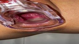 クスコ 中出后 膣内丸見