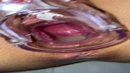 クスコ 中出后 膣内丸見2