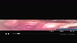 クスコ 子宮膣内丸見1