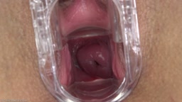 1205 Abella クスコ