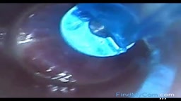 Endoscope POV: Test Tube Cock Urethral Insertion