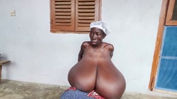 巨乳症(観覧注意)