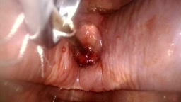 ライブチャット