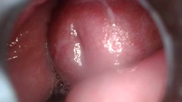 膣内視鏡を挿入しながら、チンポも入れて中出し撮影