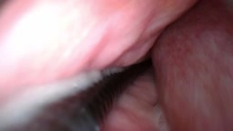 内視鏡とチンポを同時挿入しながら中出し撮影(画角失敗気味)