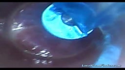 Endoscope POV: Test Tube Cock Urethral Insertion