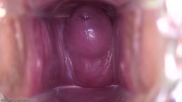 ライブチャット