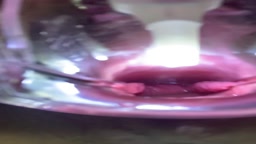 クスコ オナニー 2