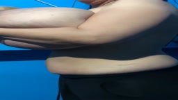 巨乳症(観覧注意)