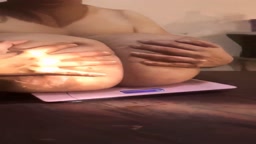 巨乳症(観覧注意)