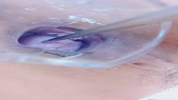 ライブチャット クスコ アナル 拡張 フィストオナニー