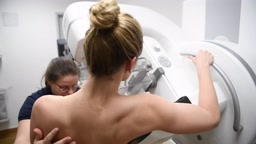 マンモグラフィ