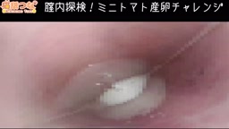 tn 膣内カメラ