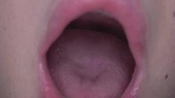 特殊な状況下における嚥下①-A