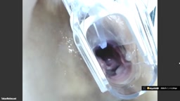 ライブチャット