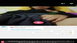 美人なのにﾃﾞｶｸﾞﾛﾋﾞﾗﾋﾞﾗ