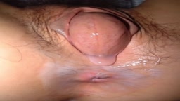 オーガズムで子宮が飛び出し肛門が広がる