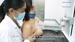 マンモグラフィ