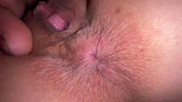 今日のうんカスチェック うんち付いたアナル