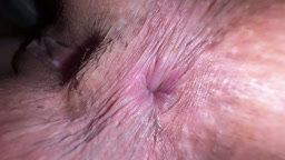 今日のウンカスチェック うんち付いたアナル うんカス