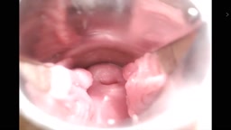 ライブチャット