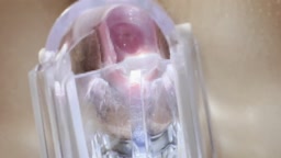 色白JD 腟内観察 1◯歳