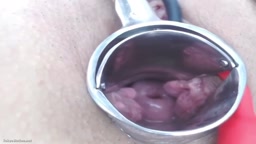 あかり尿道・子宮 ライブチャット まとめ