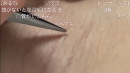 nmf①