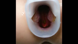 Anal アナル