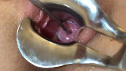 子宮頸部への刺激・挿入 Loveskelly Cervix Play\Penetration