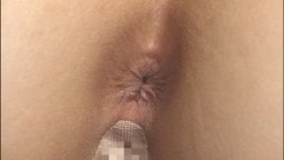 アナル