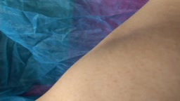 IV