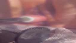 il