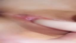 CN
