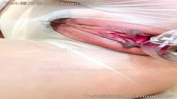 クスコ 子宮丸見え