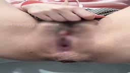 💩