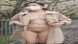 露出