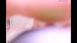 ライブチャット