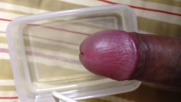 尿道 特殊