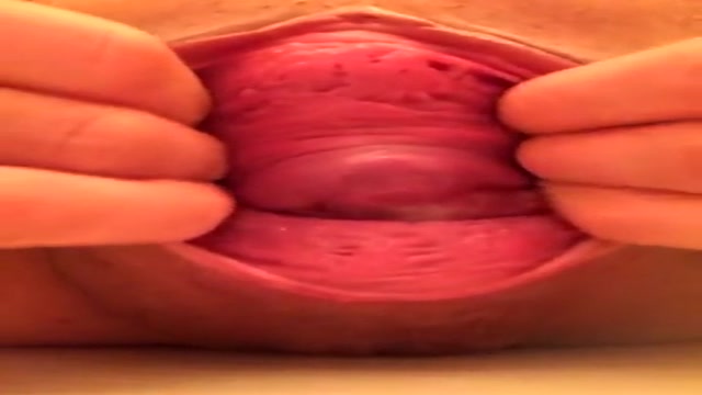 脱肛 脱膣 子宮脱