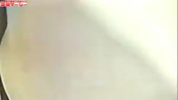 日美整形麻酔015