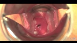 可愛い子のマンコをクスコで観察